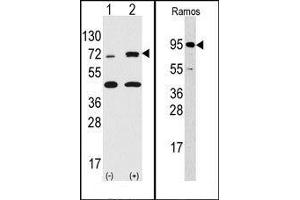 Image no. 1 for anti-Ribosomal Protein S6 Kinase, 90kDa, Polypeptide 3 (RPS6KA3) (N-Term) antibody (ABIN360345) (RPS6KA3 anticorps  (N-Term))