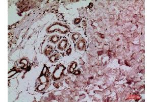 Immunohistochemistry (IHC) analysis of paraffin-embedded Human Skin, antibody was diluted at 1:100. (IL-1 beta anticorps  (Internal Region))