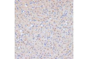 Immunohistochemistry of paraffin-embedded rat ovary using CDK9 antibody (ABIN6129241, ABIN6138331, ABIN6138332 and ABIN6214015) at dilution of 1:100 (40x lens). (CDK9 anticorps  (AA 153-372))