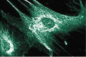 Immunofluorescence staining of human intestinal smooth muscle cells (HISM). (ANKS1B anticorps  (AA 107-268))