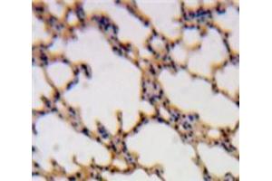 Used in DAB staining on fromalin fixed paraffin-embedded Lung tissue (SH2D1A anticorps  (AA 18-115))