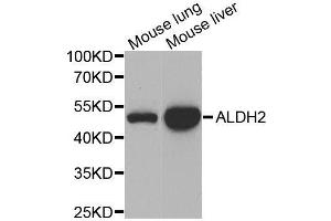 Western blot analysis of extracts of various cell lines, using ALDH2 antibody. (ALDH2 anticorps  (AA 1-380))