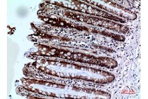 Immunohistochemical analysis of paraffin-embedded human-colon, antibody was diluted at 1:100.