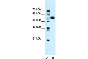 Western Blotting (WB) image for anti-DKFZP781I1119 antibody (ABIN2461018) (DKFZP781I1119 anticorps)