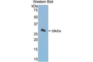Western blot analysis of the recombinant protein. (A1BG anticorps  (AA 22-219))