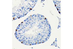 Immunohistochemistry of paraffin-embedded mouse testis using SOX9 antibody (ABIN7270577) at dilution of 1:100 (40x lens).