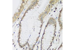Immunohistochemistry of paraffin-embedded human stomach using METTL7A antibody. (METTL7A anticorps)