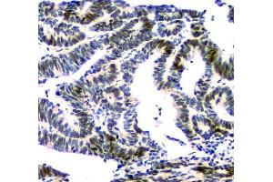 IHC analysis of NFIA using anti-NFIA antibody (ABIN6719349).