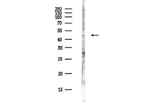 anti-Protein Z, Vitamin K-Dependent Plasma Glycoprotein (PROZ) antibody