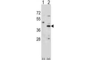 Western Blotting (WB) image for anti-Hydroxy-delta-5-Steroid Dehydrogenase, 3 beta- and Steroid delta-Isomerase 1 (HSD3B1) antibody (ABIN2998094) (HSD3B1 anticorps)