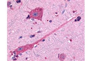 Anti-DRD2 antibody IHC of human brain, neurons and glia.