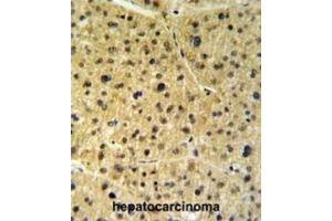 Immunohistochemistry (IHC) image for anti-FK506 Binding Protein 9, 63 KDa (FKBP9) antibody (ABIN3003182)
