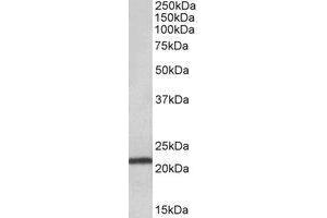 AP22431PU-N TMEM205 antibody staining of Human Pancreas lysate at 0. (TMEM205 anticorps  (Internal Region))