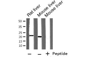Western blot analysis of FTH1 expression in various lysates (FTH1 anticorps  (C-Term))