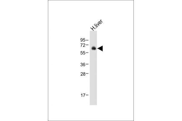 UGT2B15 anticorps  (AA 156-185)