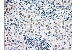 Image no. 6 for anti-Mitogen-Activated Protein Kinase Kinase 4 (MAP2K4) antibody (ABIN1499481)