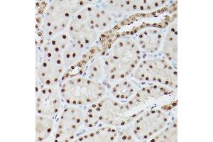 Immunohistochemistry of paraffin-embedded rat kidney using PSME3 Rabbit pAb (ABIN6135015, ABIN6146357, ABIN6146358 and ABIN6216428) at dilution of 1:100 (40x lens).