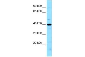WB Suggested Anti-LIMS2 Antibody Titration: 1. (LIMS2 anticorps  (N-Term))