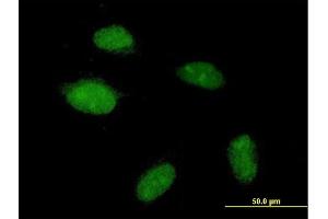 Immunofluorescence of purified MaxPab antibody to POGZ on HeLa cell. (POGZ anticorps  (AA 1-1357))