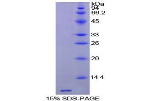 SDS-PAGE analysis of Horse Thymosin beta 4 Protein. (TMSB4X Protéine)