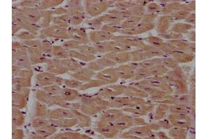 IHC image of ABIN7163226 diluted at 1:100 and staining in paraffin-embedded human heart tissue performed on a Leica BondTM system.