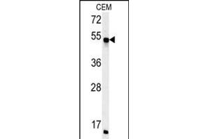 FKBP8 Antibody (Center) (ABIN652170 and ABIN2840576) western blot analysis in CEM cell line lysates (35 μg/lane). (FKBP8 anticorps  (AA 199-226))