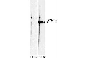 Western blot analysis of Akt (pT308). (AKT1 anticorps  (pThr308))