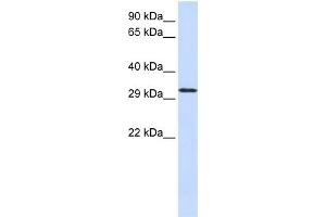 WB Suggested Anti-C21orf2  Antibody Titration: 0. (C21orf2 anticorps  (N-Term))
