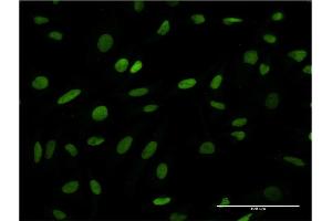 Immunofluorescence of monoclonal antibody to ANP32B on HeLa cell.