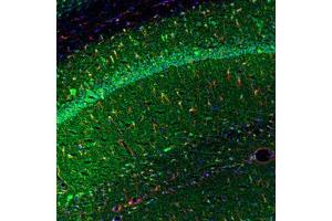 Image no. 1 for anti-Tumor Necrosis Factor alpha (TNF alpha) antibody (ABIN465805) (TNF alpha anticorps)