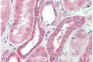 Human Kidney: Formalin-Fixed, Paraffin-Embedded (FFPE)