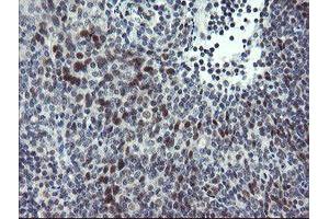 Image no. 8 for anti-Zinc Finger, BED-Type Containing 1 (ZBED1) antibody (ABIN1501794)