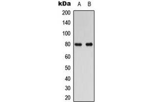 Western blot analysis of RAD17 expression in human Oral cancer (A), HuvEc (B) whole cell lysates. (RAD17 anticorps  (C-Term))