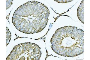 IHC analysis of ACLY using anti-ACLY antibody (ABIN4886416).