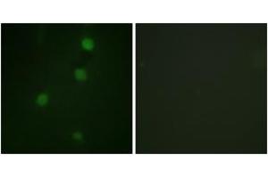 Immunofluorescence analysis of NIH-3T3 cells, using Retinoblastoma (Ab-821) Antibody. (Retinoblastoma Protein (Rb) anticorps  (AA 791-840))