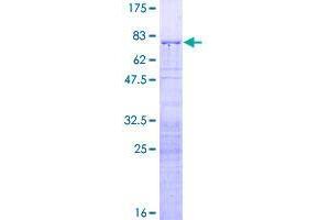 Image no. 1 for RRS1 Ribosome Biogenesis Regulator (RRS1) (AA 1-365) protein (GST tag) (ABIN1318917)