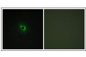 Immunofluorescence analysis of COS7 cells, using EPHA6 Antibody.