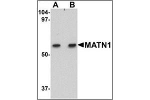 Western blot analysis of MATN1 in rat liver tissue lysate with this product at (A) 1 and (B) 2 μg/ml. (MATN1 anticorps  (C-Term))