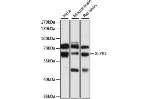 Western blot analysis of extracts of various cell lines, using GLYR1 antibody. (GLYR1 anticorps)