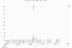 Image no. 1 for Salusin alpha (Salusin alpha) protein (Ovalbumin) (ABIN1880269) (Salusin alpha Protein (Salusin alpha) (Ovalbumin))