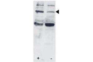 Western blot testing of p-STAT3 antibody and HL-60 cells/lysate collected before (-) or after (+) stimulation with IFN-a.