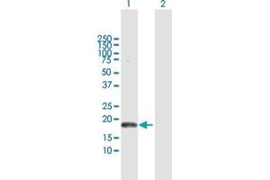 Western Blot analysis of PLA2G16 expression in transfected 293T cell line by PLA2G16 MaxPab polyclonal antibody. (PLA2G16 anticorps  (AA 1-162))