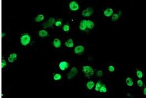 Image no. 4 for anti-SUMO1/sentrin/SMT3 Specific Peptidase 2 (SENP2) (AA 139-523) antibody (ABIN1490925)