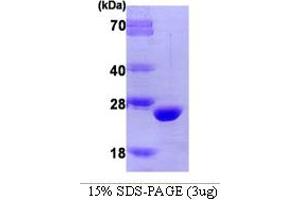 SDS-PAGE (SDS) image for Catechol-O-Methyltransferase (COMT) (AA 51-271) protein (ABIN666744)