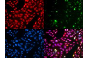 Immunofluorescence analysis of U2OS cells using CUL4B antibody (ABIN6130211, ABIN6139255, ABIN6139258 and ABIN6221048). (Cullin 4B anticorps  (AA 1-200))
