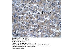 Rabbit Anti-LHX6 Antibody     Paraffin Embedded Tissue: Human Liver  Cellular Data: Hepatocytes  Antibody Concentration: 4. (LHX6 anticorps  (C-Term))