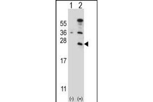 Western blot analysis of CD3E (arrow) using rabbit polyclonal CD3E Antibody (C-term) (ABIN657454 and ABIN2846481). (CD3 epsilon anticorps  (C-Term))