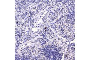 IHC analysis of HE4 using anti-HE4 antibody (ABIN5693137). (WFDC2 anticorps  (AA 31-124))