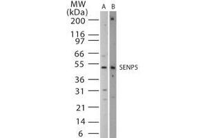 Image no. 1 for anti-SUMO1/sentrin Specific Peptidase 5 (SENP5) (AA 229-246) antibody (ABIN208763) (SENP5 anticorps  (AA 229-246))