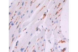 Used in DAB staining on fromalin fixed paraffin- embedded heart tissue